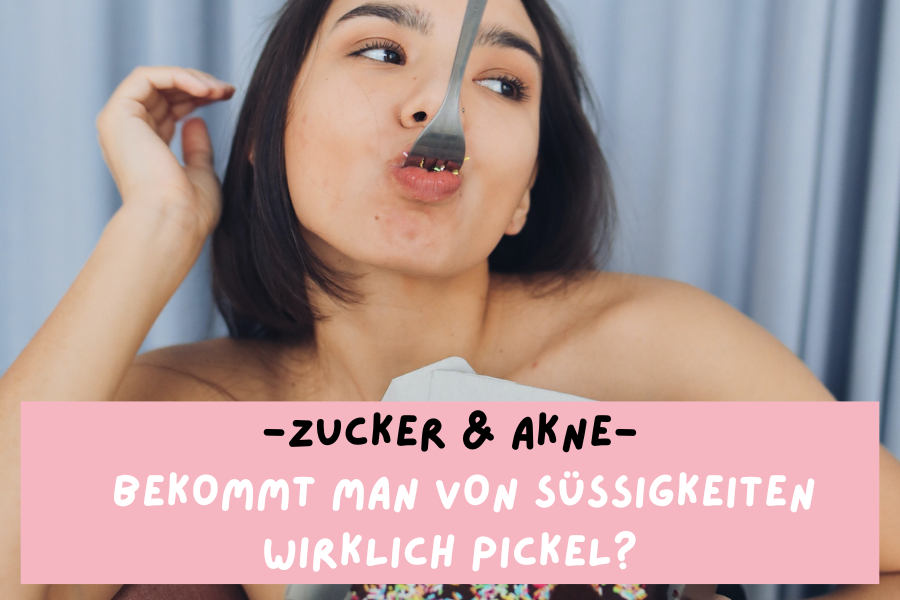 Zucker & Akne – Bekommt man von Süßigkeiten wirklich Pickel? Zucker & Akne – Bekommt man von Süßigkeiten wirklich Pickel?