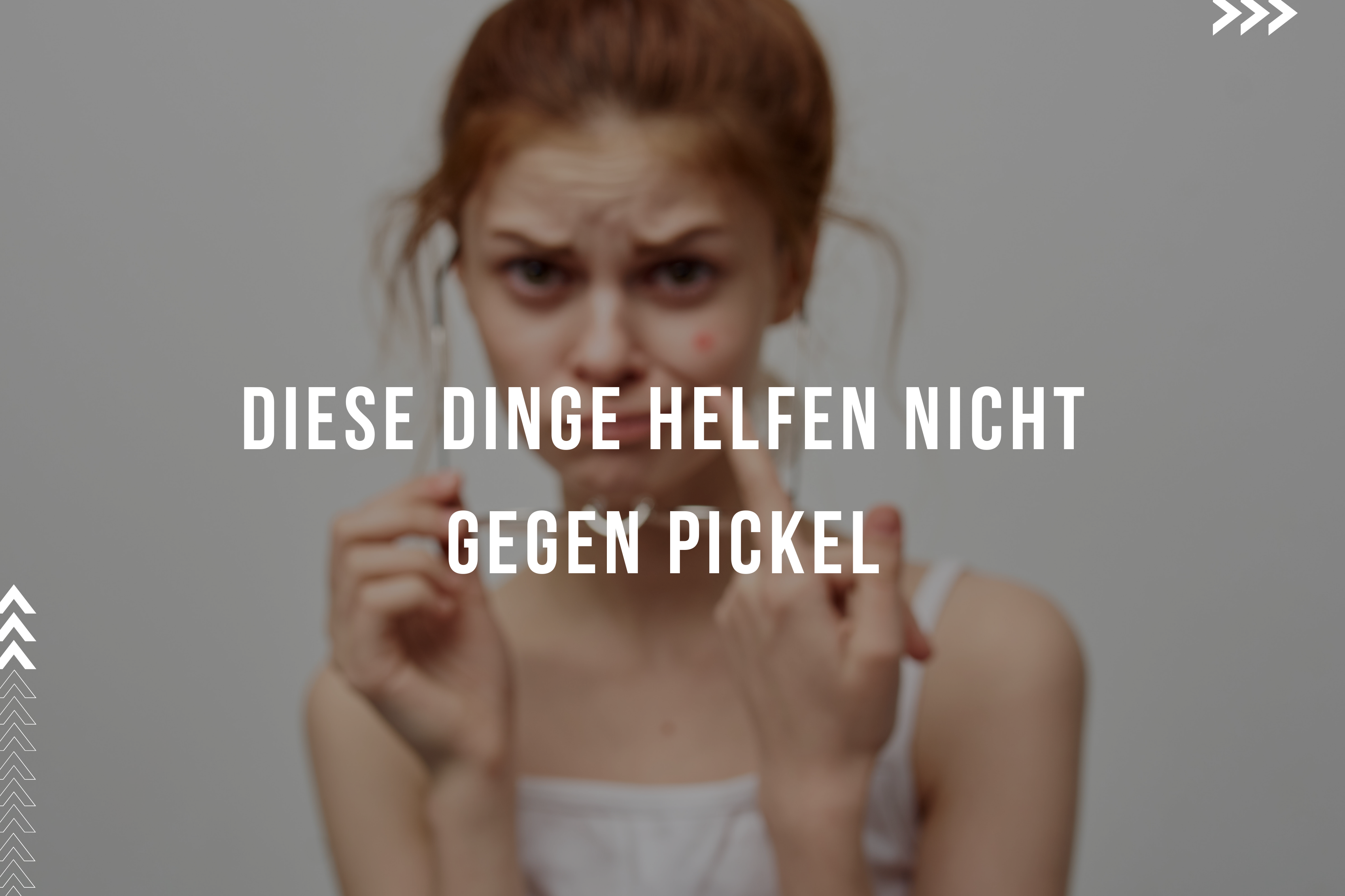 Diese Dinge helfen NICHT gegen Pickel Diese Dinge helfen NICHT gegen Pickel