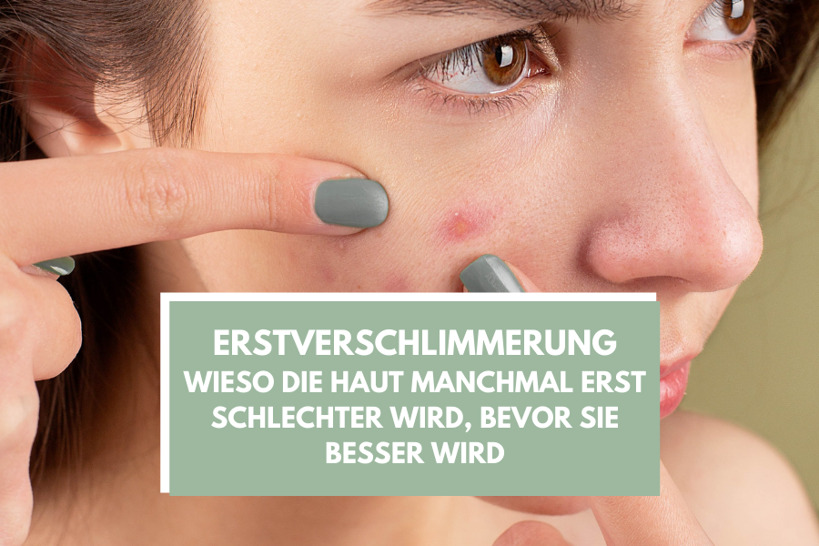 Erstverschlimmerung – Wieso die Haut manchmal erst schlechter wird, bevor sie besser wird Erstverschlimmerung – Wieso die Haut manchmal erst schlechter wird, bevor sie besser wird
