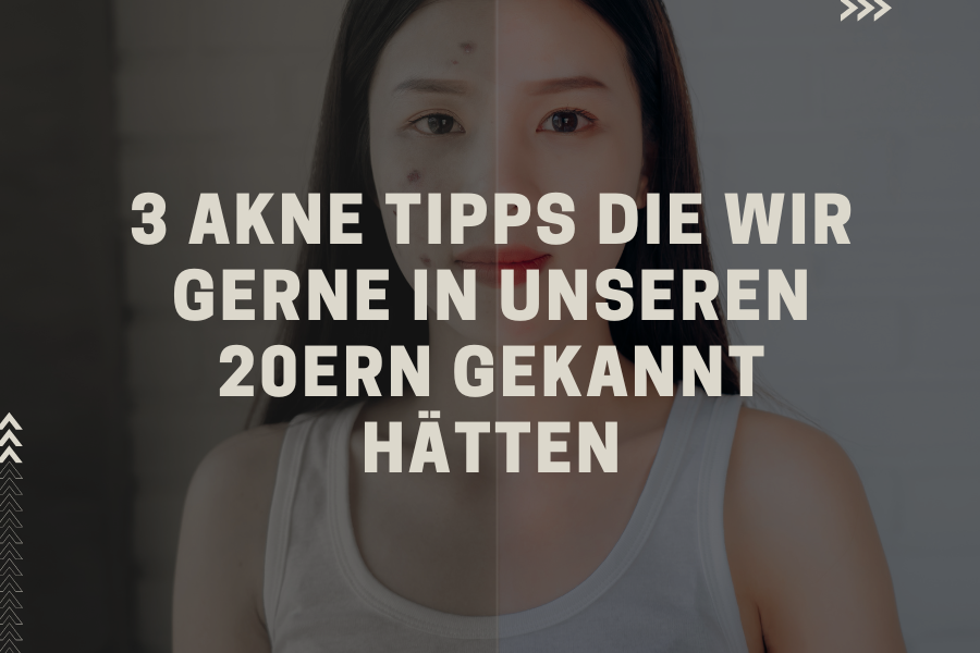 3 Akne Tipps die wir gerne in unseren 20ern gekannt hätten 3 Akne Tipps die wir gerne in unseren 20ern gekannt hätten