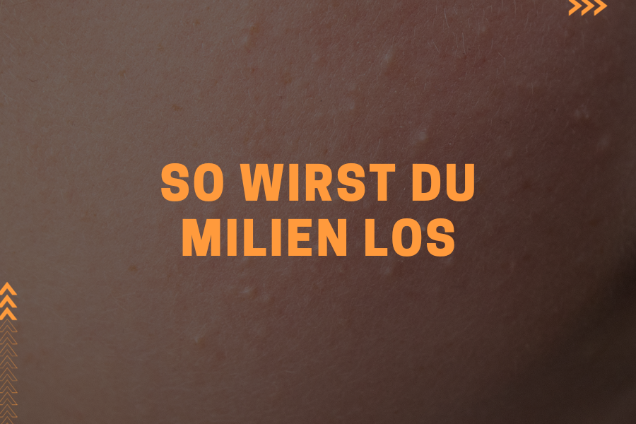 So wirst du Milien los So wirst du Milien los
