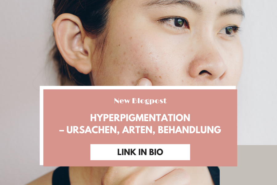 Hyperpigmentation – Ursachen, Arten, Behandlung Hyperpigmentation – Ursachen, Arten, Behandlung