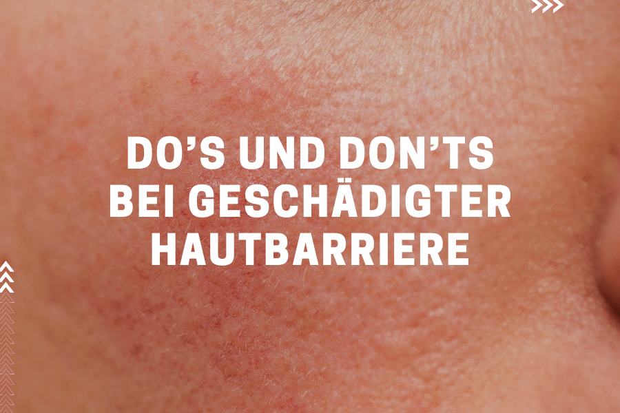 Do’s & Don‘ts bei geschädigter Hautbarriere Do’s & Don‘ts bei geschädigter Hautbarriere