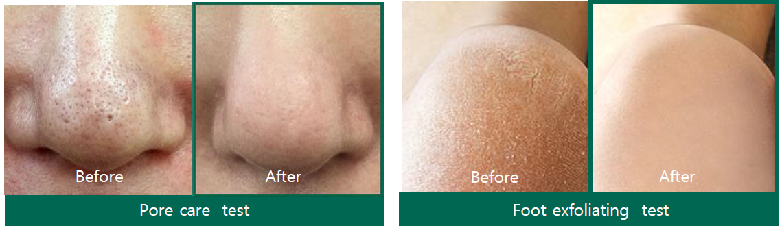 SOMEBYMI AHA-BHA-PHA Miracle Acne Cleansing Bar