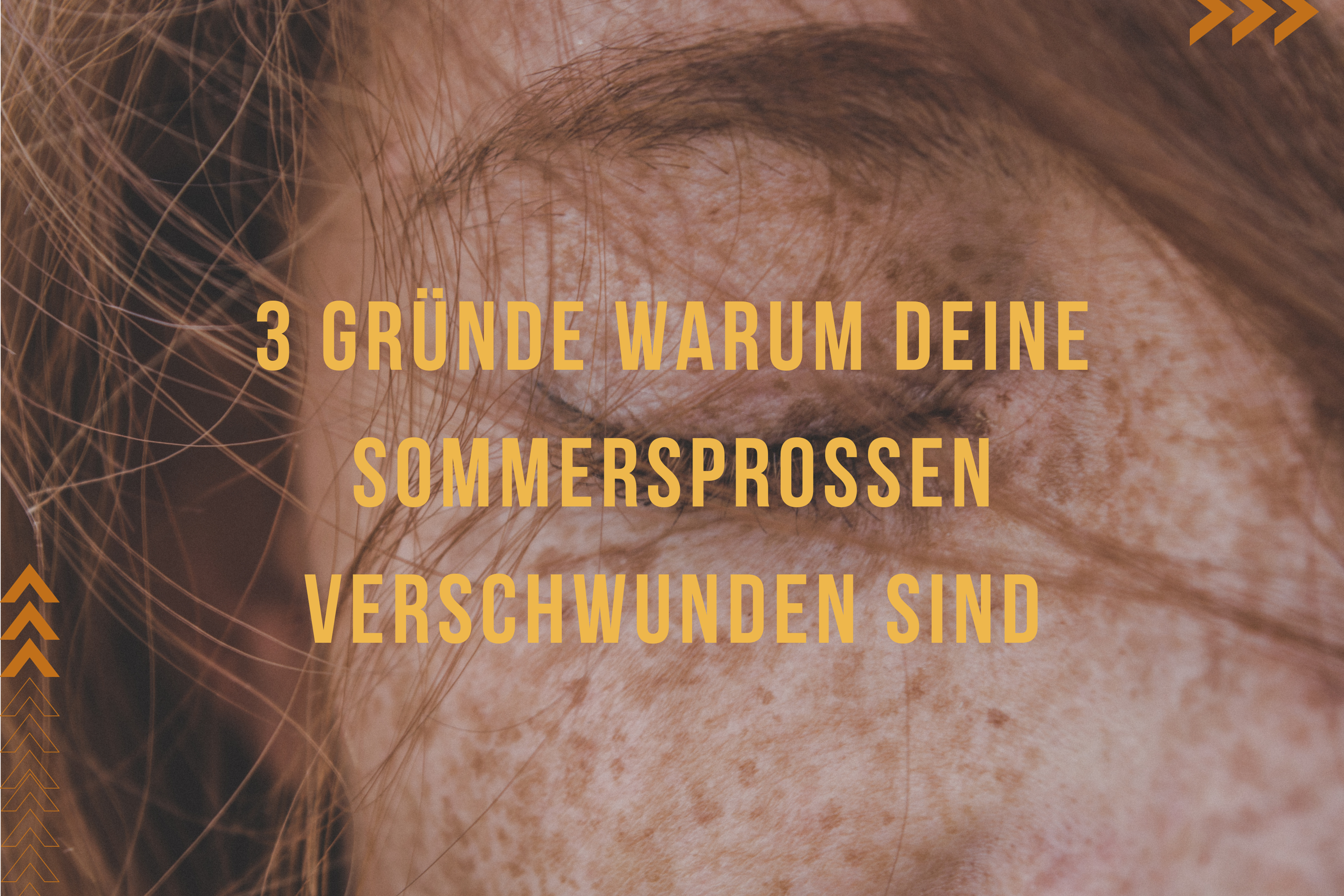 3 Gründe warum deine Sommersprossen verschwunden sind 3 Gründe warum deine Sommersprossen verschwunden sind