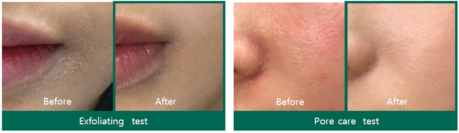 SOMEBYMI AHA-BHA-PHA 30 days Miracle Toner SOMEBYMI AHA-BHA-PHA 30 days Miracle Toner