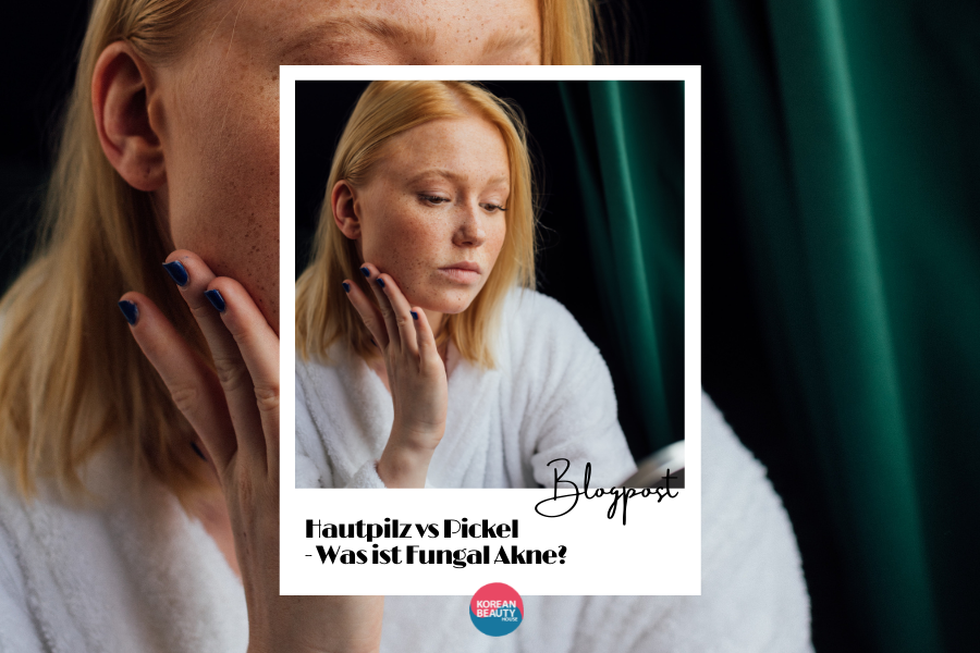Hautpilz vs Pickel – Was ist Fungal Akne? Hautpilz vs Pickel – Was ist Fungal Akne?