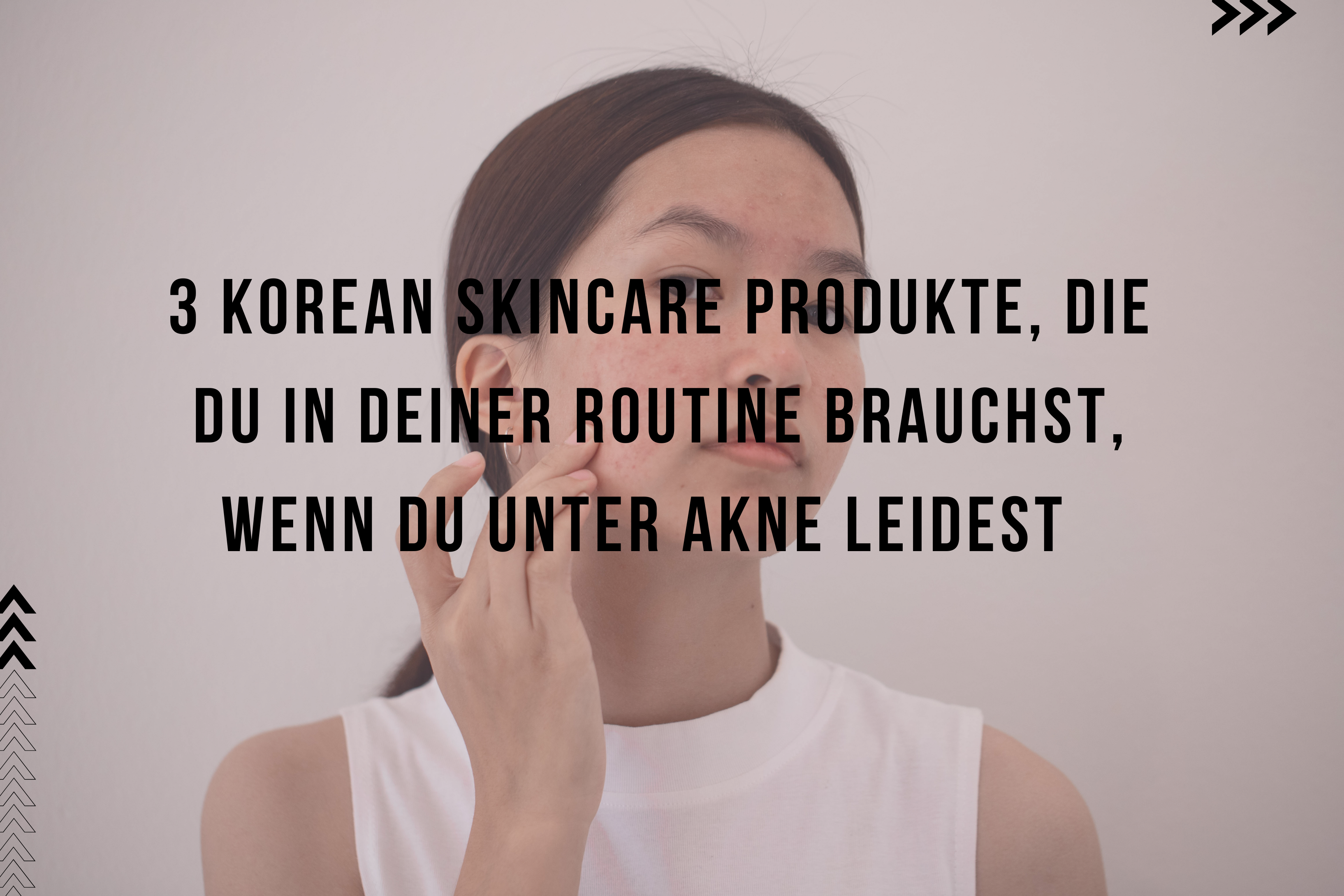 3 Korean Skincare Produkte, die du in deiner Routine brauchst, wenn du unter Akne leidest! 3 Korean Skincare Produkte, die du in deiner Routine brauchst, wenn du unter Akne leidest!