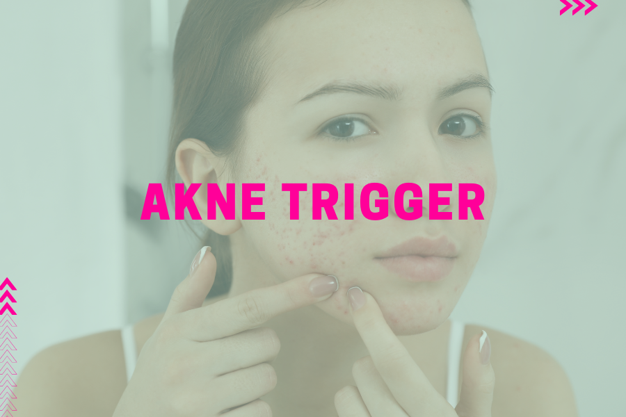Akne Trigger – Vorsicht, das kann Pickel begünstigen! Akne Trigger – Vorsicht, das kann Pickel begünstigen!