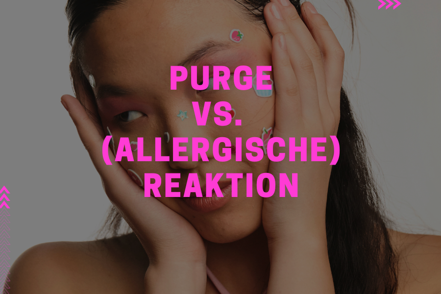 Purge vs (allergische) Reaktion – So merkst du den Unterschied Purge vs (allergische) Reaktion – So merkst du den Unterschied