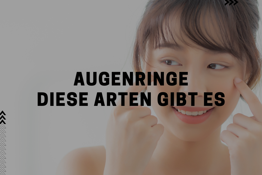 Diese Arten von Augenringen gibt es Diese Arten von Augenringen gibt es
